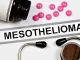 Best Mesothelioma Attorney Assistance